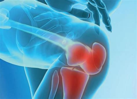 О причинах и лечении ноющей тянущей боли в коленном суставе